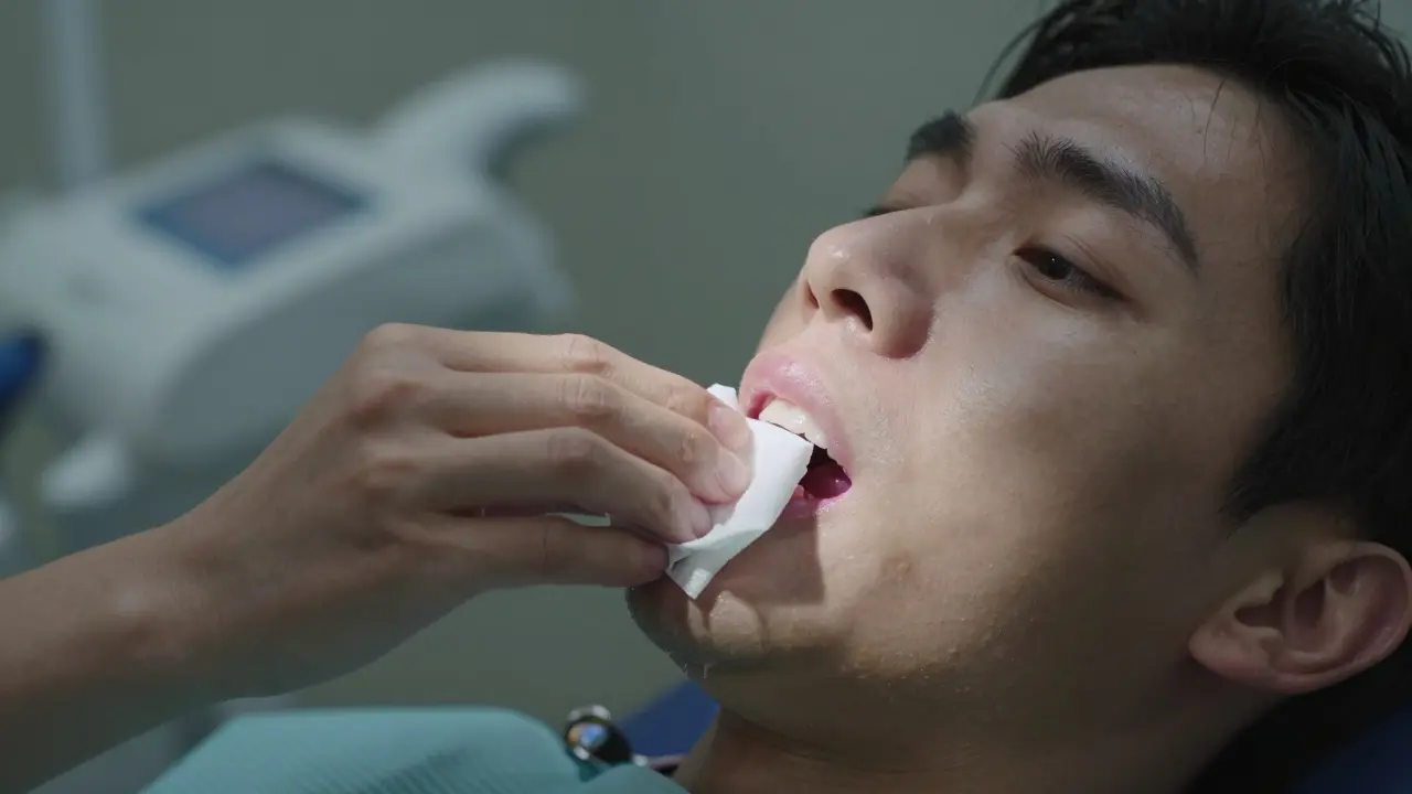 Jak dlouho teče krev po vytržení zubu? Průběh a co očekávat