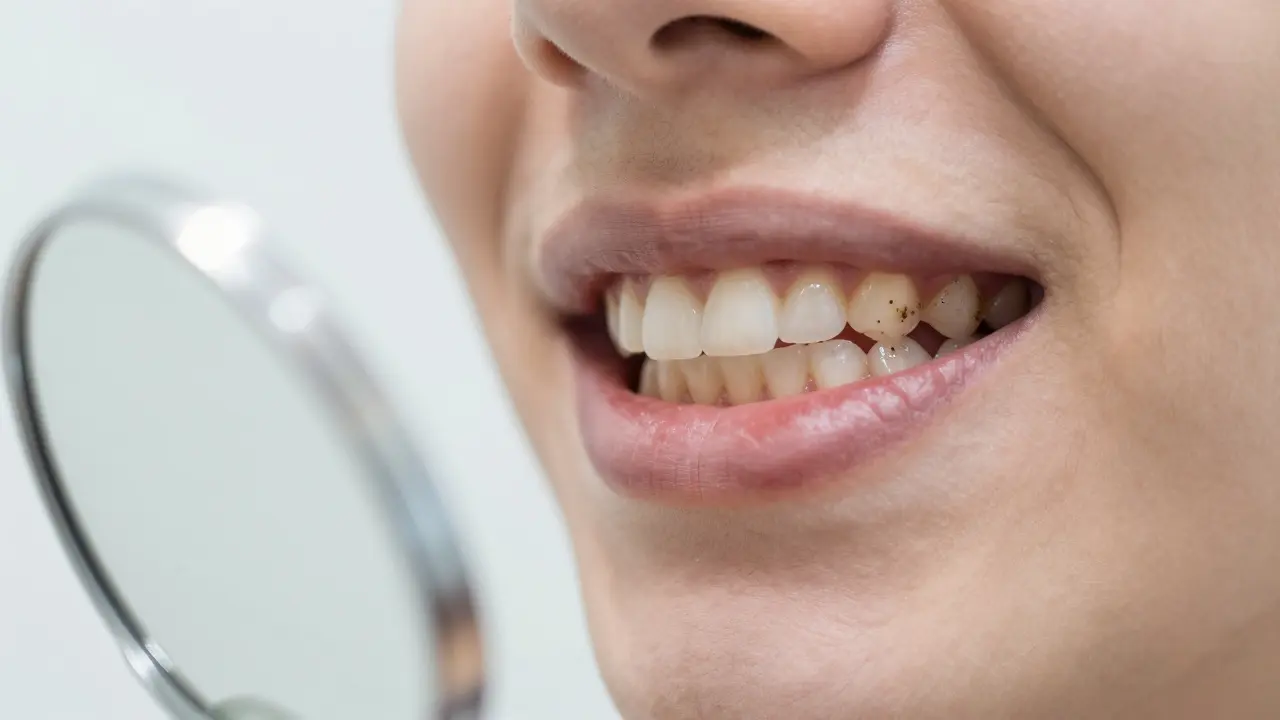 Černý zubní kámen: Fakta, mýty a jak se zbavit tmavých usazenin