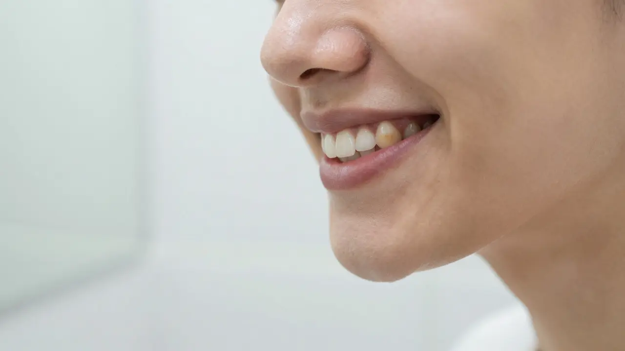 Jak zastavit kaz v zubu a co dělat, když už máte díru