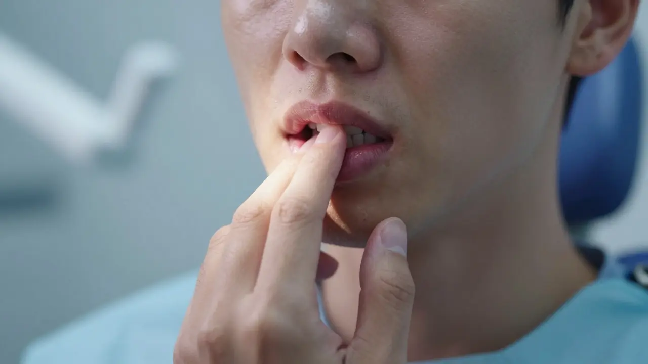 Veneers zuby: Jak se vyhnout problémům a zajistit dlouhou životnost